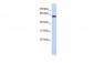 EYA1 antibody - middle region